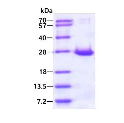 SDS-PAGE Recombinant Human ARL14 His Protein